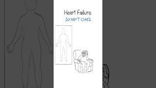 Heart failure symptoms EXPLAINED #shorts #healthsketch #heart