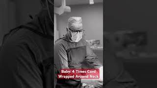 Miracle Baby: Born with Umbilical Cord Wrapped 4 Times