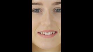 Instasmile clip in veneers (2).mov