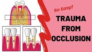 Trauma From Occlusion (TFO) | PERIODONTOLOGY
