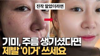 30대 이상인데 ' 이 성분' 안쓰면 피부 좋아질수 없어요