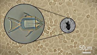 Shape-Morphing Microrobots Deliver Drugs to Cancer Cells | Headline Science