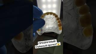 У вас Аллергия? #съёмныепротезы #зубныепротезы #протезированиезубов #протезирование #стоматология