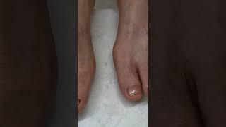 3번을 발톱을 뺐던 고객#아픔을참지말고#살롱드퀸즈로#두꺼운발톱