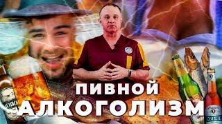 ПИВНОЙ АЛКОГОЛИЗМ: симптомы, стадии, иллюзии | Какой вред от пива и последствия злоупотребления?