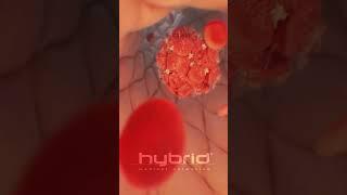 Venous thromboembolism | Deep vein thrombosis (DVT)  | #thrombosis  #medicalanimation #bloodclot