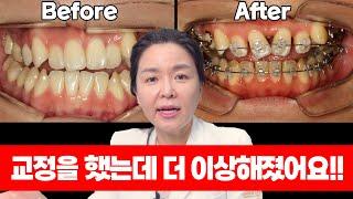 분명히 교정을 했는데 더 이상해질 수가 있는 건가요??