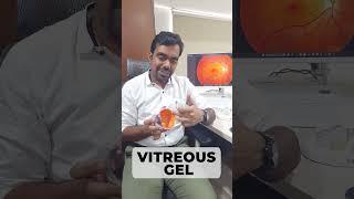 Retina - Its Connection To Your Eyes | Dr. Rohit Agrawal | #Retina