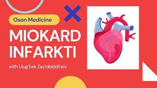 Miokard Infarkti | Kardiologiya