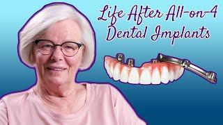 Life After All on 4 Dental Implants - 8 Months Post Surgery