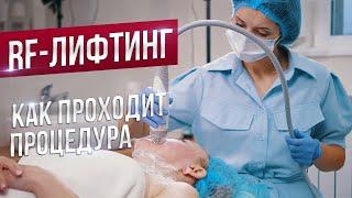 Как проходит процедура RF-лифтинга