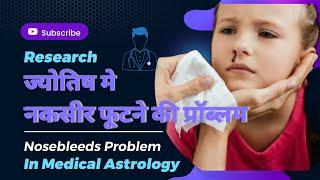 नकसीर फूटने की प्रॉब्लम  | Nosebleeds In Medical Astrology |