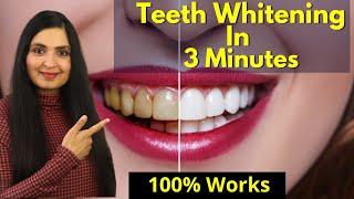 Teeth Whitening At Home In 3 Minutes | How To Whiten Your Yellow Teeth Naturally| Easy, Quick, Safe