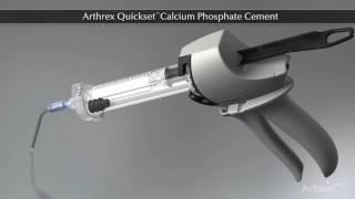 Arthrex Quickset™ Calcium Phosphate Cement