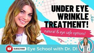 Under Eye Wrinkle Treatments That Are Natural and Safe For Eyes! Organic Under Eye Wrinkle Treatment