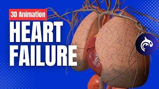 Heart Failure - 3D Animation