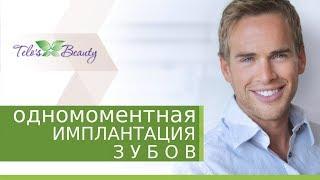 Одномоментная имплантация.  Как проходит одномоментная имплантация зубов у ортопеда. Telo's Beauty