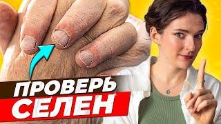 ПОЛЬЗА И  ВРЕД СЕЛЕНА || Кому нужен селен, как определить дефицит, селен при гипотиреозе