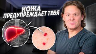 Красные точки на теле - это ОПАСНО! Как вылечить ангиомы НАВСЕГДА?