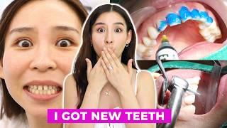 I Got a Dental Makeover in Korea  