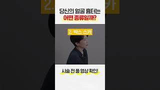 흉터 치료 전 필독 내 얼굴의 흉터는 어떤 종류 인가요?