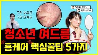 10대 학령기 여드름 없애는 방법, 청소년 여드름 집에서 하는 스킨케어