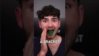 Best Braces Snack - Sour Edition!! #shorts