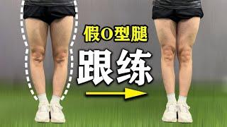 假性O型腿矫正训练，每天一遍，两周见效丨Pseudo O shaped leg correction training, once a day, effective in two weeks