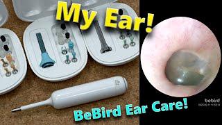 EARS ARE GROSS! BeBird EarSight Cleaning Cameras Review!