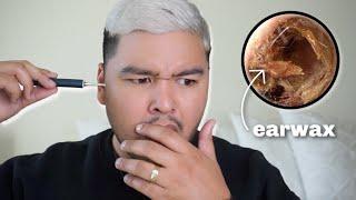 Using An Earwax Cleaning Camera For The First Time | alantimoteov