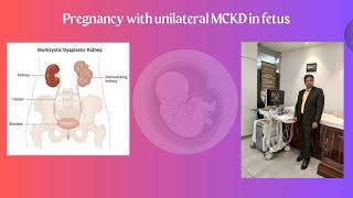 Pregnancy with unilateral MCKD in fetus