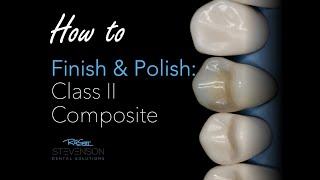 How to Finish and Polish a Class II Composite