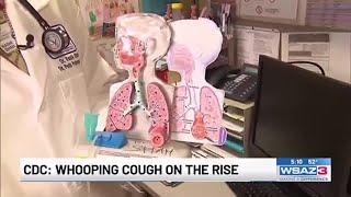 CDC: Whooping cough on the rise