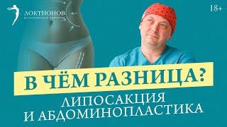 Липосакция или Абдоминопластика? Что выбрать? Можно ли делать 2 операции одновременно? / 18+