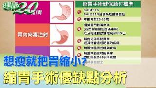 想瘦就把胃縮小？縮胃手術優缺點分析給你聽 健康2.0