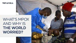 Mpox: The Disease Causing Sleepless Nights