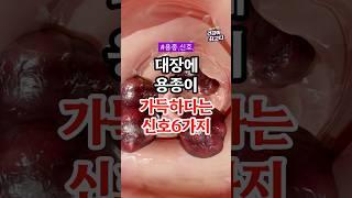 대장에 용종이 가득하다는 신호 6가지 #건강 #건강정보