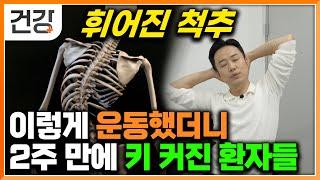 "척추 건강 찾고 키까지 커졌죠" 일석이조의 효과를 보는 척추측만증 바로잡는 14일 운동법│귀하신 몸│#EBS건강