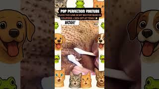 Wow! #pimplepopping #pimple #pimples #shortsfeed #shortvideo #shorts #short #youtube #youtubeshorts