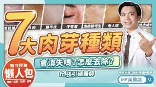 眼周脖子小顆粒怎去除？息肉、汗管瘤、病毒疣…7大類肉芽治療方法評比ft.張引碩醫師【ME美醫誌】