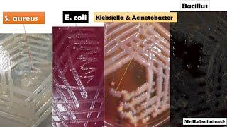 Most Common Bacterial Colony Morphology/ E. coli/Klebsiella/Pseudomonas/Proteus/Staphylococcus/Baci