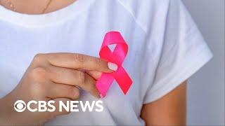 Doctor answers common breast cancer, mammogram questions