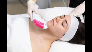 NEW Ultraformer MPT  | The Newest Generation of Ultraformer Skin Tightening