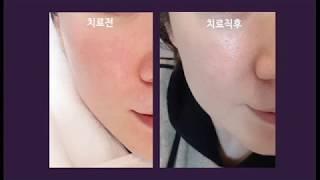 건조하고 예민한 피부, 이게 딱!_도곡양재차앤박피부과