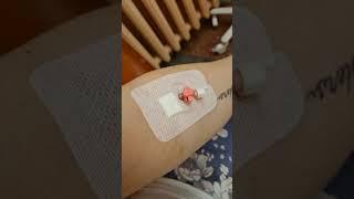 #shorts  Попала в больницу 