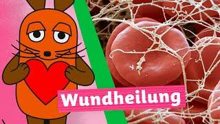 Wie heilt eine Wunde? | Die Maus | WDR