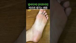 발바닥에 안티푸라민 바르면 생기는 놀라운 변화 #건강 #건강정보