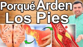 PORQUE ARDEN LOS PIES? - Causas Y Soluciones Para El Adormecimiento U Hormigueo