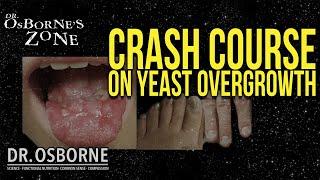 Crash Course on Yeast Overgrowth