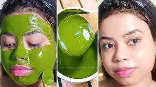 Remove Dark Spots, Acne Pimples with Natural Ingredients |Visible Spotless Glowing Skin After 7 Days